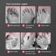 thumbnail image 4 of Corrector de Juanetes Hueso Pulgar Ajustador Likrtyny Cuidado de los Pies, 4 of 9