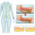 thumbnail image 4 of Ultrasonic Liquefaction Hand Strap, Matteo Ultrasonic Body Shape Wristband,For All, 4 of 4