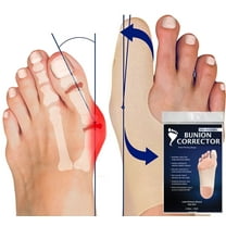 Bunion Bootie Ultra-Thin Bunion Corrector Sleeve for Women & Men, Shoe-Friendly, Breathable - Medium-Right