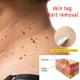 thumbnail image 4 of Líquido para el tratamiento de las verrugas de la verruga de la etiqueta de la piel de 10 ml contra el ungüento del remedio del removedor de lunares, 4 of 8