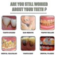 thumbnail image 5 of 10/20/30pcs Ampoule Toothpaste, Ampoule Tooth Serum, Ampoule Essence Toothpaste -, 5 of 5