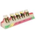 thumbnail image 2 of Disease Model, Demonstration Teeth Model Eco Friendly  For Classroom Hospital For  Hospital, 2 of 8