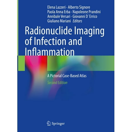 UPC: 9783030621742 | Radionuclide Imaging of Infection and Inflammation: A Pictorial Case-Based Atlas (Hardcover)