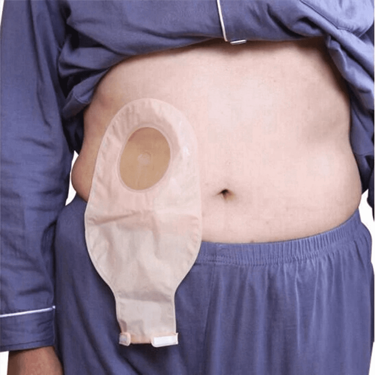 60x Ostomy Bags Drainable Pouches for Colostomy Ileostomy Stoma Care 20-60mm
