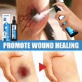 thumbnail image 4 of Scar Repair Treatment Wound Spray Wound Repair, 4 of 4