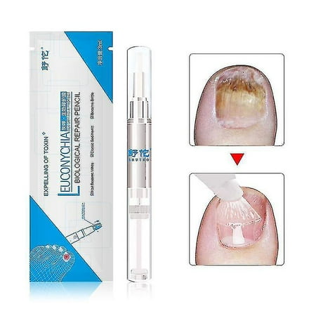 3ml Fungus Treatment Nail Oil Pen Anti-fungal Nail Cuticle Remover ...