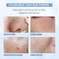 thumbnail image 3 of ANLAN Peeling Ultrasonico Facial, Skin Scrubber, Espatula Ultrasonica Facial, Ultrasonico Facial, Roja Y Azul Led, Ems Antiedad Arrugas, Exfoliador Limpiador De Poros, Ipx7 (Blanco), 3 of 7