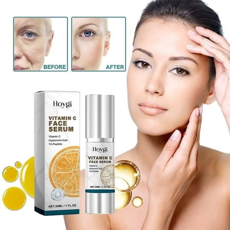 Total Package Serum, Vitamin C, Hyaluronic Acid, Vitamin C Face Serum, Reduces Dark Spots Skin Brightening Vitamin C Face Serum