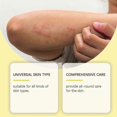 thumbnail image 2 of Psoriasis Cream, Skin Relief Anti-itch Cream Psoriasis Cream, Safe & Effective, Natural Herbal Skin Soothing Cream, 2 of 4