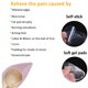thumbnail image 2 of Almohadillas metatarsianas de gel para la bola del pie, paquete de 8 unidades, FCYIMI, 2 of 7
