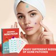 thumbnail image 2 of BUY 2 SAVE 10%!Maojin 200 pegatinas de espinillas de estrellas, pegatinas antiacné para el cuidado de la piel, herramientas de maquillaje de belleza Facial, 50ml, 2 of 6