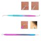 thumbnail image 4 of Blackhead Remover Set, Stainless Steel Comedone Squeezer Set 7 Pieces Set Of Ear Cleaners Made Of Stainless Steel Pimple Remover, 4 of 5