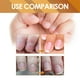 thumbnail image 4 of EELHOE Gel instantáneo para el cuidado de la cutícula, reparación de onicomicosis, uñas suaves, uñas rotas, solución de cuidado hidratante para la piel muerta,2 piezas, 4 of 9