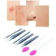 thumbnail image 5 of Kit De Pinzas Para Quitar Puntos Negros, Herramienta De Eliminación De Espinillas Ampliamente Utilizada, Práctica Y Portátil De Acero Inoxidable Con Toalla De Compresión, 5 of 7