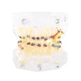 thumbnail image 1 of WALFRONT Dental Orthodontic Treatment Malocclusion Study Teeth Model With Wire Chain, Malocclusion Model,Orthodontic Model, 1 of 7