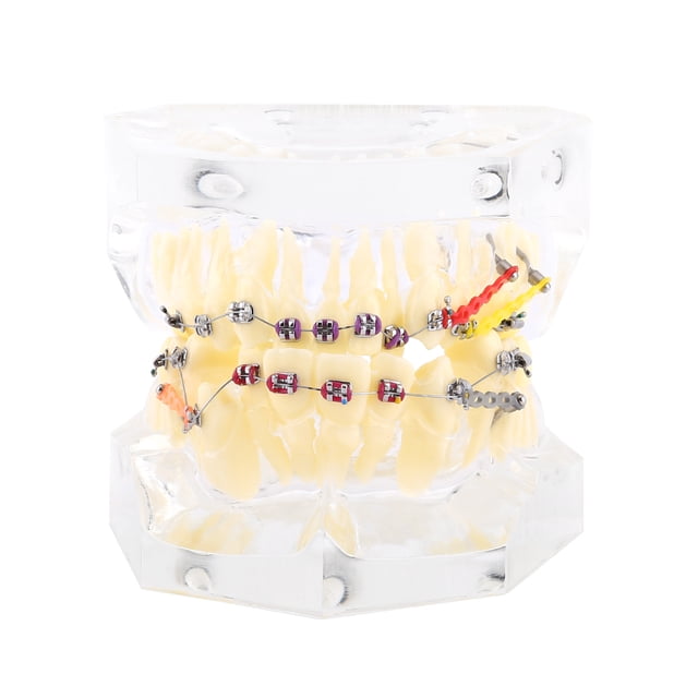WALFRONT Dental Orthodontic Treatment Malocclusion Study Teeth Model With Wire Chain, Malocclusion Model,Orthodontic Model