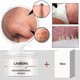 thumbnail image 1 of Huamade 2pack Nose Strips Blackhead Remover Aloe Peel Off Mask Facial Pore Cleanser Purifying Nose Mask, 1 of 5