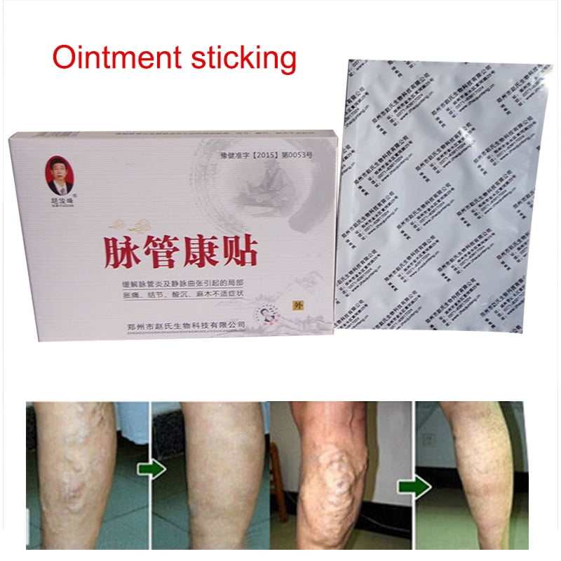 Varicose Veins Cure Patch Plaster Vasculitis Chinese Herbal Medicine Treatment