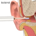 thumbnail image 4 of Ear cera eliminación oreja limpiador de oreja face earwax limpiador removedor seguro accesorio accesorio oídos herramientas para el hogar cuidado del cuerpo cuidado limpio uso blanco Advancent HA011374-02, 4 of 7
