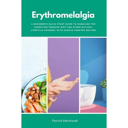 Erythromelalgia: A Beginner's Quick Start Guide to Managing the Condition Through Diet and Other Natural Lifestyle , (Paperback)