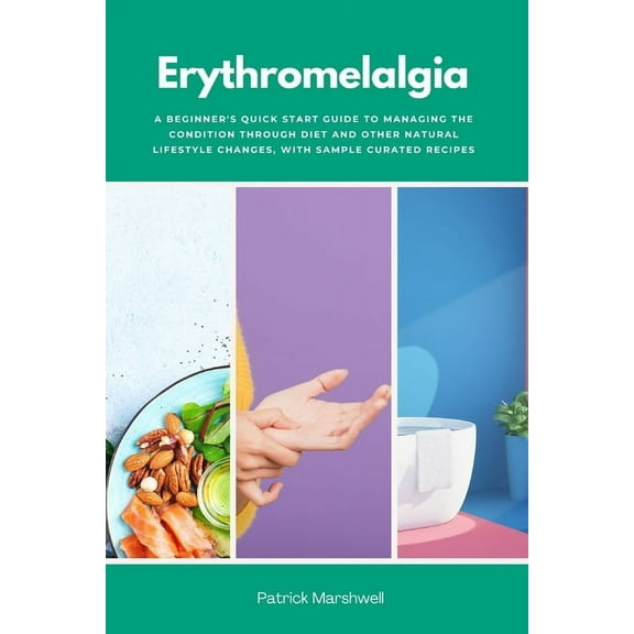 Erythromelalgia: A Beginner's Quick Start Guide to Managing the Condition Through Diet and Other Natural Lifestyle , (Paperback)