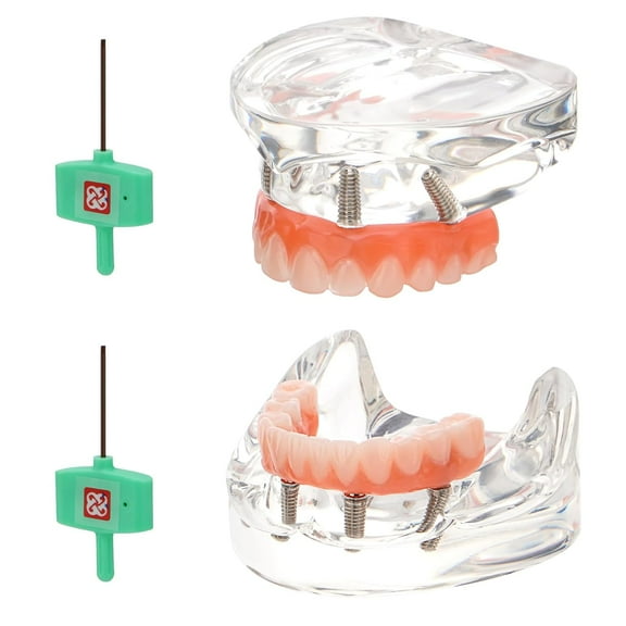 Dental Implant Model: All-on-4 Dental Implants Model with Transparent Base and Removable Crown, Included with Upper & Lower Jaw