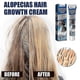 thumbnail image 5 of 1-3X New Alopecia Treatment Cream Hair Growing Prevent Alopecia Baldness Regrowth 20g, 5 of 5
