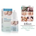 thumbnail image 3 of Líquido Reparador de Uñas Ganfancp 10Ml Esmalte de Uñas Rebajas Flash Deals, 3 of 7