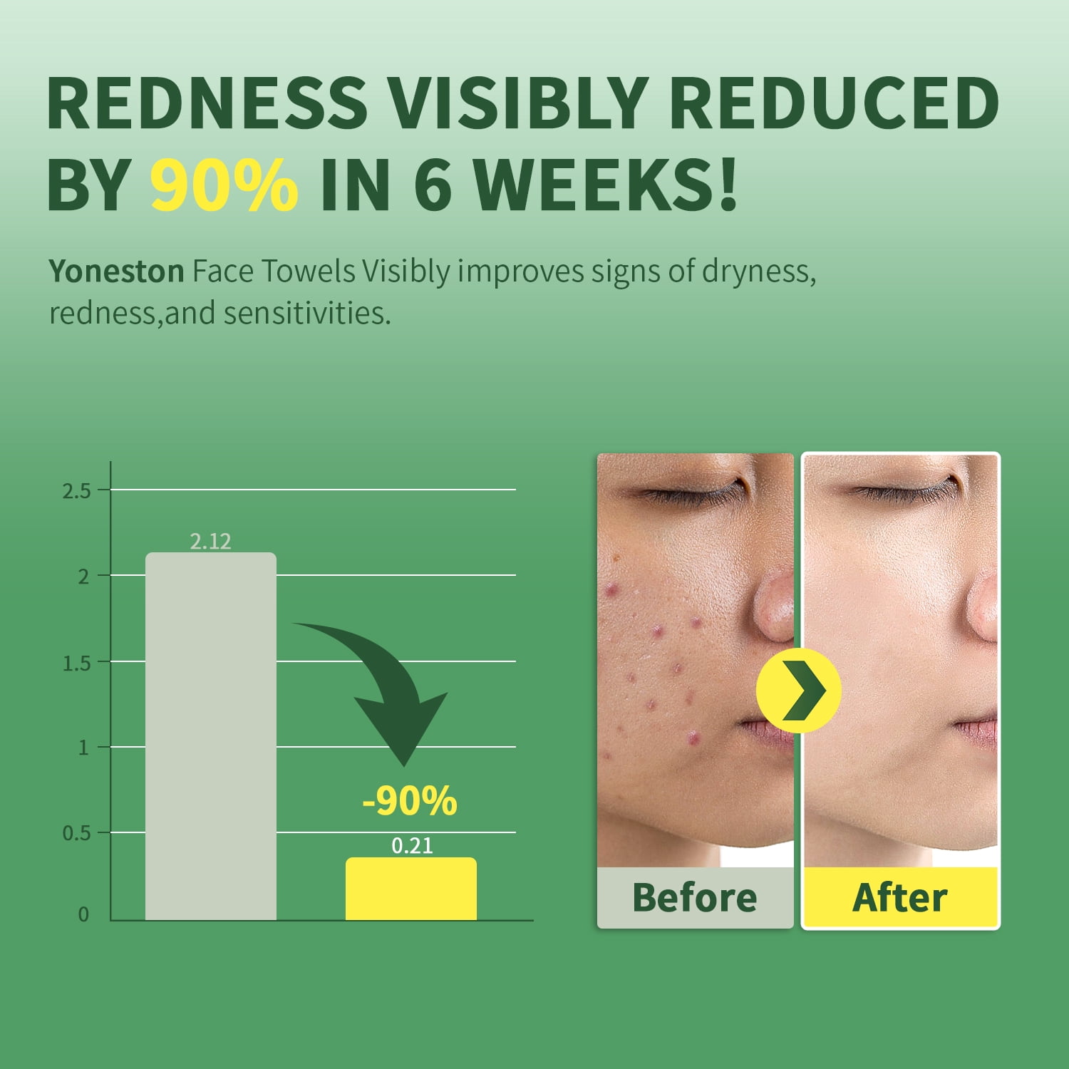 Yoneston Disposable Face Towels, 10" x 12" Biodegradable Large Face Skin Clean Washcloth for Sensitive Skin, Makeup Remover, Facial Cleansing, Nursing, Travel, 50 Count (1 Pack)