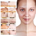thumbnail image 2 of Set de cuidado facial y jabón de cúrcuma Derperzi con cepillo, 2 of 9