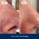 thumbnail image 5 of Tónico exfoliante Hero Cosmetics Pore Release 100 ml, 5 of 9