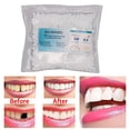 thumbnail image 4 of Kit de reparación de Dientes temporal Sunnimix 25G Cuidado Bucal Dientes Falsos Moldeables 4 piezas, 4 of 8