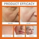 thumbnail image 5 of Crema para el tratamiento de la piel APKAPK Bee Venom Firming Wrinkle, paquete de 2, 5 of 7