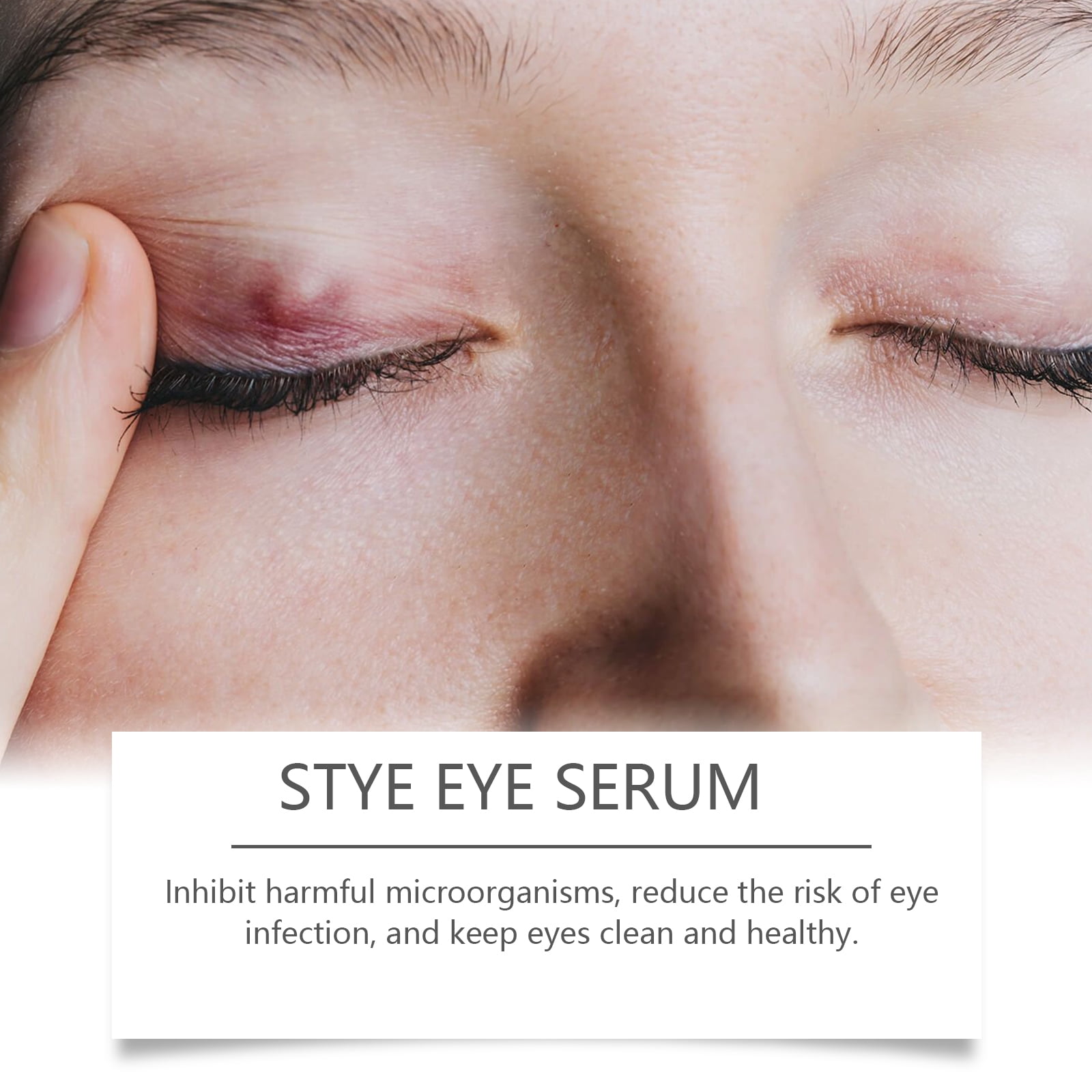 Alvantor Stye Eye Serum with Herbal Extracts for Puffiness and Redness, Fast Absorbing, 1 Fl.Oz
