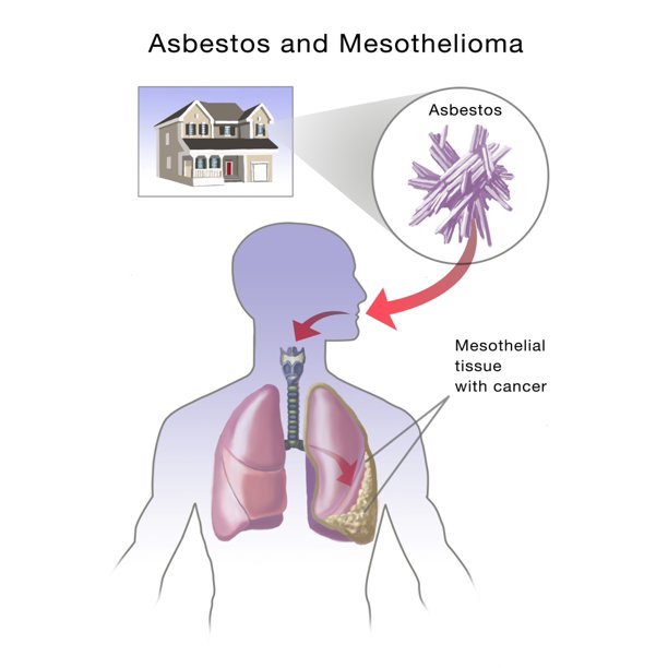 Blood Test Congestive Heart Failure Bnp