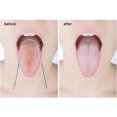 thumbnail image 4 of Kit de raspador de lengua de acero inoxidable, paquete de 3 limpiadores de lengua de acero inox Carevas Limpiadores de lengua, 4 of 6