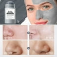 Deep Blackhead Removal Videos 2023 - tef1g40