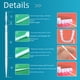thumbnail image 1 of Palillo de dientes independiente Tooth Point, 400 piezas, transparente, de plástico, separado, 1 of 2