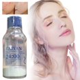 thumbnail image 2 of ICE LERSKIN Precision Say Goodbye To Stubborn And Say To Smooth Skin Fade Marks Repair Skin Barrier Gently For Skin 30ml|White, 2 of 8