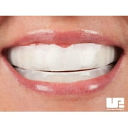 New April 2022 - Opalescence Go 15% Teeth Whitening Trays (10 pack, Mint Flavor, Boxed)