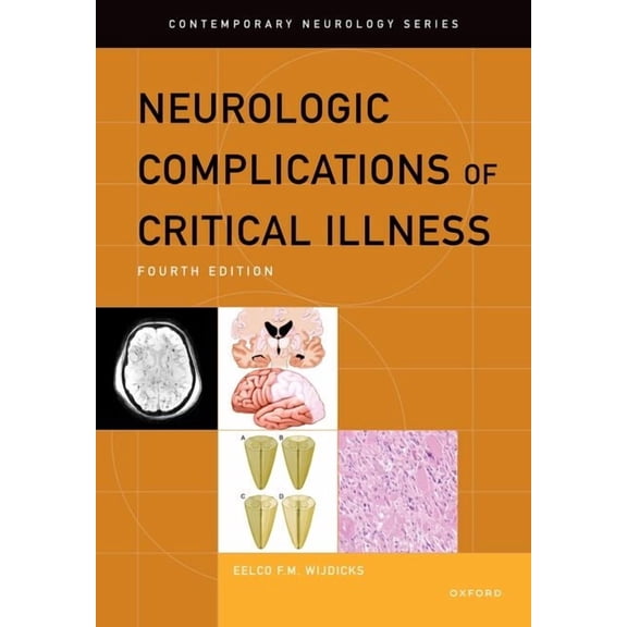 Contemporary Neurology Neurologic Complications of Critical Illness, (Hardcover)