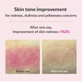 thumbnail image 3 of Serum isoi Blemish Care Up 70 ml con arbutina y aceite de rosa búlgara, 3 of 9