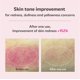 thumbnail image 3 of Serum isoi Blemish Care Up 70 ml con arbutina y aceite de rosa búlgara, 3 of 9