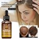 thumbnail image 1 of Fiudx Acetaminofén En Crecimiento Del Cabello, Solución Capilar En Extractos Naturales de Plantas, Fórmula En Café de Ricino B7, Masaje En Rodillo Estimulante para Cuero Cabelludo, para Cabello Fino, 1 of 7