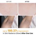 thumbnail image 2 of Body Keratin Care Spray — 200ml (Kojic Acid & Turmeric Formula) | Suitable for All Skin Types |Makeup Organizers, 2 of 4