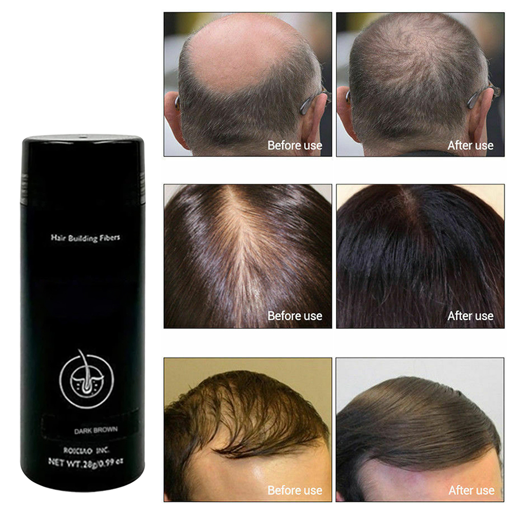 Buy SANAG 28g Hair Fibers Hair Building Fibers for Thinning Hair Hair Loss Online at Lowest