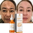 thumbnail image 1 of Suero blanqueador facial con vitamina C, elimina manchas oscuras, pecas, Retinol de melanina, esencia antiarrugas, brillo, cuidado de la piel coreano, 1 of 5