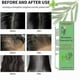 thumbnail image 4 of Organic Rosemary Essential Oil for Hair Strengthening & Scalp Nourishment, Natural Growth Support Treatment, 4 of 5