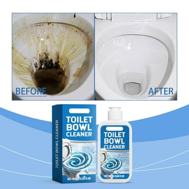 Fmlxio Home Cleaning Toilet Bowl Cleaner Toilet Bowl Cleaner 100ml Rollbacks