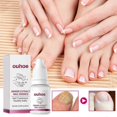 thumbnail image 2 of Ginger Nail Treatment - Nail Fungus Removal, Nail Fungus Treatment for Toenail Strengthens and Smooths Cracked Nail Surface, Ginger Nail Essence Repai, 2 of 5